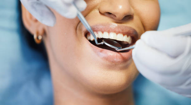 Best Emergency Root Canal Treatment in Coldwater, MI
