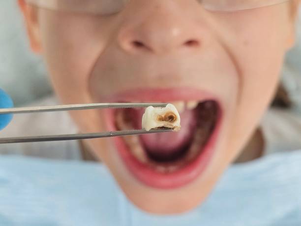 Best Emergency Dental Services for Seniors in Coldwater, MI