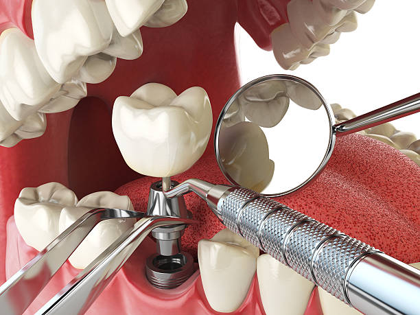 Best Emergency Dentist for Knocked-Out Tooth in Coldwater, MI